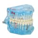 thumbnail image 2 of Modelo de dientes para enfermedades dentales estructura detallada azul transparente desmontable aprendizaje modelo de enseñanza patológica acrílico para hospital dental ANGGREK Otros, 2 of 8