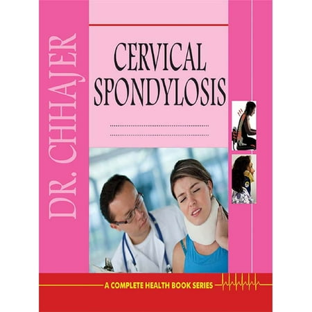 Cervical Spondylosis - eBook (Best Treatment For Cervical Spondylosis In India)