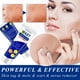thumbnail image 5 of Crema para eliminar verrugas SEFUDUN Eliminador de Marcas en la Piel 20 g, 5 of 7
