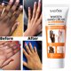 thumbnail image 3 of Suero blanqueador rápido para nudillos oscuros, crema antigrietas, correctores de pigmentación para piel negra, productos para eliminar manchas intensas, 3 of 5