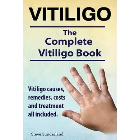 Vitiligo. Vitiligo Causes, Remedies, Costs and Treatment All Included. the Complete Vitiligo