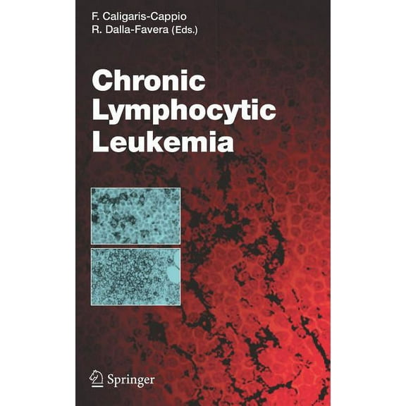Current Topics in Microbiology and Immmu Chronic Lymphocytic Leukemia, Book 294, (Hardcover)