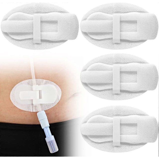 cubierta de sonda de alimentación, fijación de catéter, clavija en j, almohadillas para sonda, suministros, drenaje foley soporte adhesivo para tubo G/J con tira de cierre; vista frontal de cinco almohadillas ovaladas blancas de material fino y transpirable con ranura y pestaña de sujeción, una aplicada en el abdomen sujetando un conector de drenaje. ligera y discreta, diseñada para fijar sondas PEG y tubos de diálisis peritoneal; a menudo usada para mantener el tubo en posición durante el día.