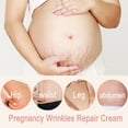 thumbnail image 3 of Crema reparadora de 50g para estrías posparto, reduce marcas de embarazo y celulitis, mejora la elasticidad de la piel para todo tipo de cutis., 3 of 7