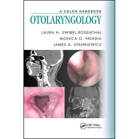 ISBN 9781482253764 product image for Otolaryngology : A Color Handbook | upcitemdb.com