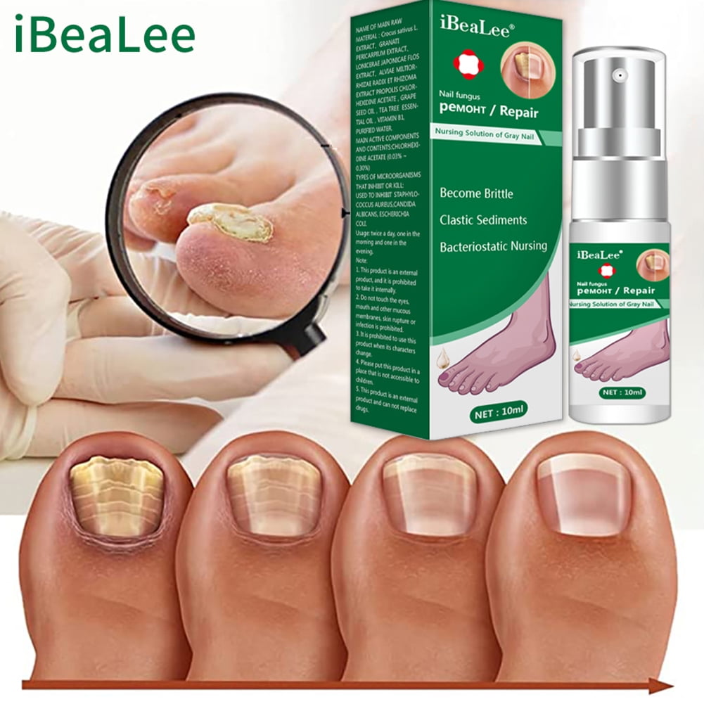 iBea Lee Nail Fungus Treatment Essence Serum Hand Care Foot Fungal Removal  Repair Gel Anti-infective Paronychia Onychomycosis 