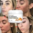 thumbnail image 3 of Crema blanqueadora de pecas, puntos negros, melasma, antimanchas, aclara la pigmentación, hidratante, productos coreanos para el cuidado de la piel, 3 of 6