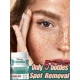 thumbnail image 2 of Crema eficaz para pecas, ilumina rápidamente la cara, elimina el Melasma, las manchas oscuras, desvanece la melanina, blanquea la pigmentación, mejora la luminosidad, 2 of 5