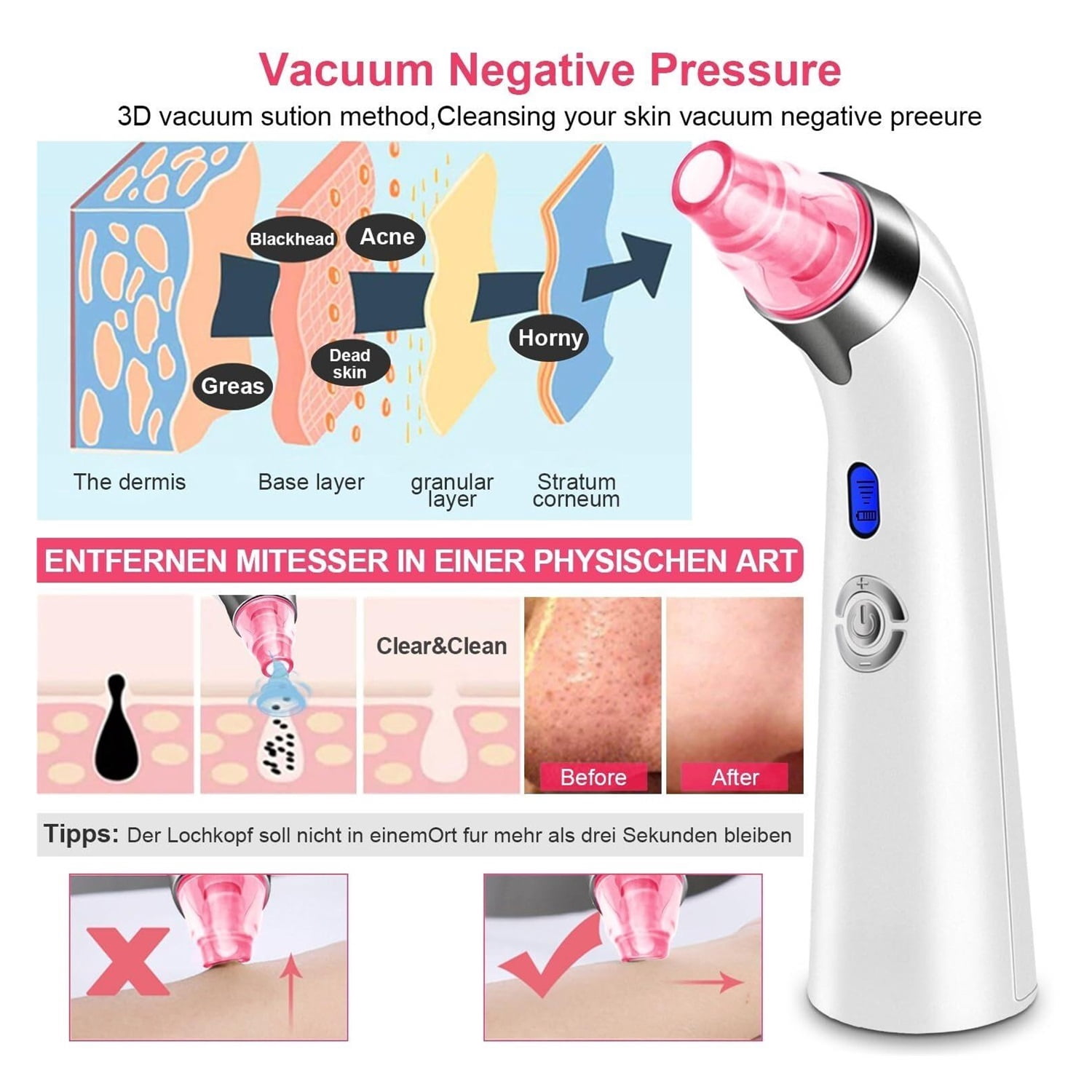 Blackhead Remover Pore Vacuum, Face Suction Pore Cleaner, 5 Suction Power Electric Blackhead Extractor Tool, 4 Probes, Blackhead Suction Remover for Women & Men