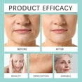 thumbnail image 4 of Crema facial regeneradora 50 g Gel hidratante rico en nutrientes Ungüento para el control de imperfecciones y la hidratación profunda, tratamiento facial calmante ligero sin fragancia sin, 4 of 7