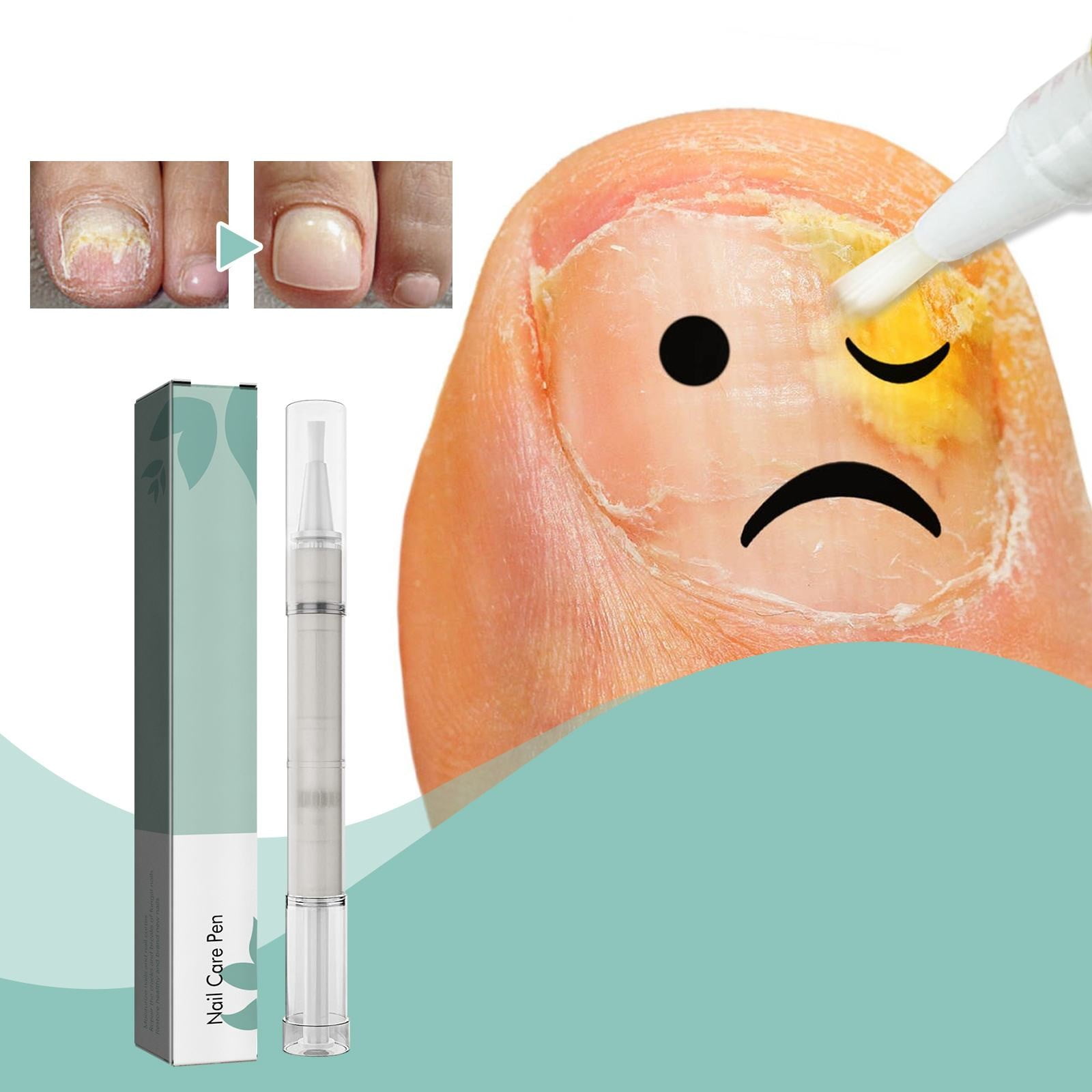 yolai nail pen for removing dead skin and barbed gray nails nourishing