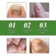 thumbnail image 4 of 1-3pcs Nail Care Roller Balls - Nourishing Massage For Stronger, Faster-growing Nails With 7-day Nail Growth Formula, 4 of 5