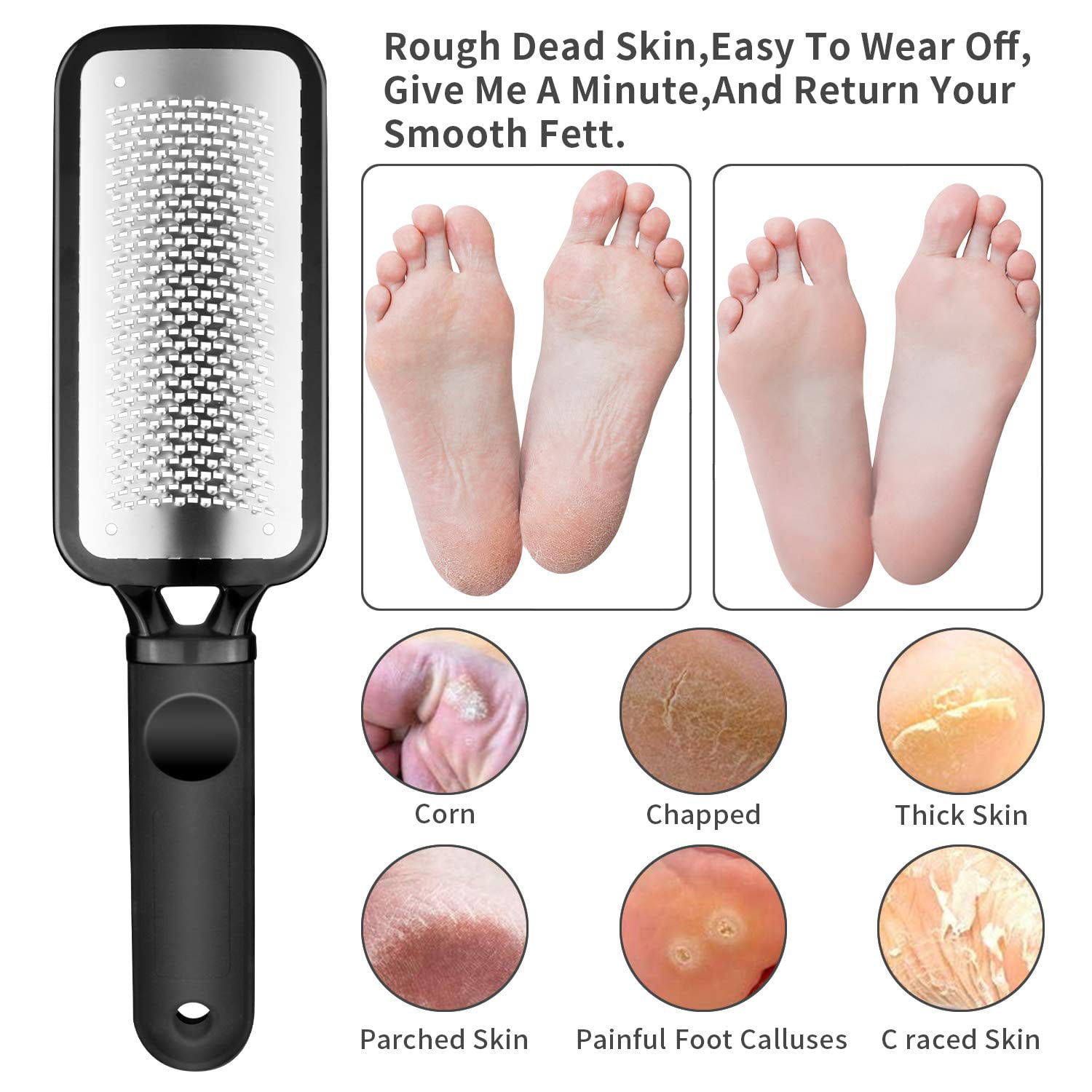 Foot File, Callus Remover for Feet with 1 pcs Smaller Holes Replacement  Blade, Colossal Metal Surface Pedicure Tools for Dead Skin, Professional