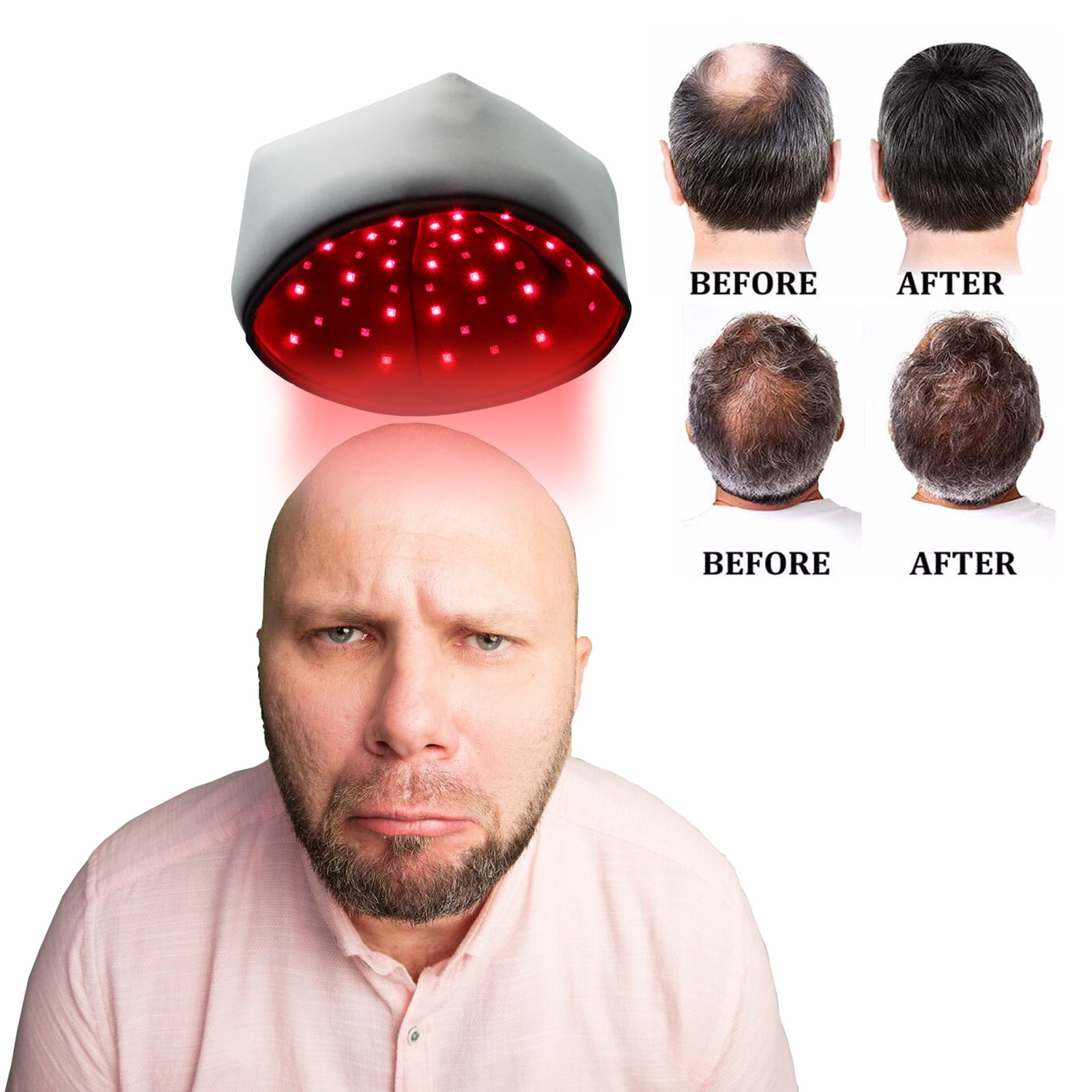 JINCBY Clearance,Mobile Light Cure Cap For Hair Growth Infrared Heating Hair Growth Cap Gift for Women