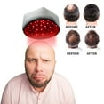 thumbnail image 3 of RKSTN A Cap Beauté & Soins Personnels Lumière Mobile pour Chauffage Infrarouge, 3 of 9