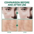 thumbnail image 3 of Silicone Scar Gel - Medical Advanced Scar Gel Gentle Formula 50ml, 3 of 3