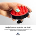 thumbnail image 3 of Medcosa Hair Brush | “The Brush Your Hair Will Thank You For” | Scalp Massager & Shampoo Scalp Exfoliator | Detangles Hair & Dislodges Dandruff, 3 of 5