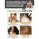 thumbnail image 4 of Prevención de la caída del cabello Premium, suero anticaída eficaz, tratamiento del cuero cabelludo, cuidado hereditario posparto seborreico del cabello, 4 of 5