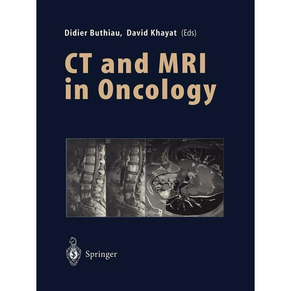 CT and MRI in Oncology, (Paperback)
