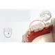 thumbnail image 2 of Protector bucal nocturno de EVA de grado alimenticio, 3 unidades, 2 of 7