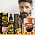 thumbnail image 1 of Regalo de aceite esencial de barba natural para hombres Herramienta de masaje con microagujas (rodillo) Likrtyny Cuidado Belleza, 1 of 9