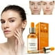 thumbnail image 1 of Vitamin C Face Serum HOT SALE!! Vitamin C For Removing Dark Vitamin C With Hyaluron Vitamin E And Pure Vitamin C For Skin（30ml/1oz）, 1 of 5