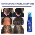 thumbnail image 3 of Hair Growth Dense Regrowth Ginger Serum Oil Anti-loss Treatment Spray 30ml, 3 of 4