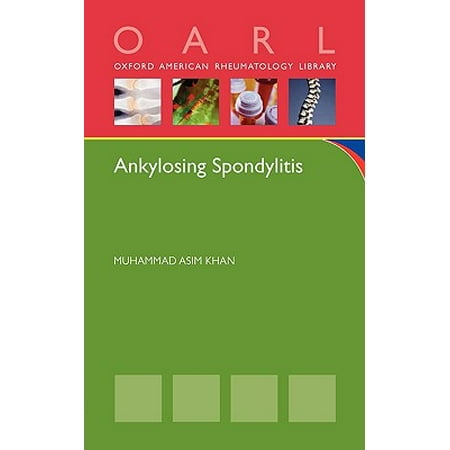 Ankylosing Spondylitis (Best Doctor For Ankylosing Spondylitis)