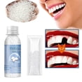 thumbnail image 2 of Pegamento de resina para reparación de dientes, relleno de huecos de dientes moldeables, pegamento sólido para reparación temporal de dientes Falseteeth, suministros dentales de seguridad, 2 of 4
