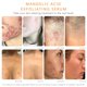 thumbnail image 5 of Sérum Purificante Corporal AlmondClear Mandélico Antibacteriano para Imperfecciones Corporales, 5 of 6