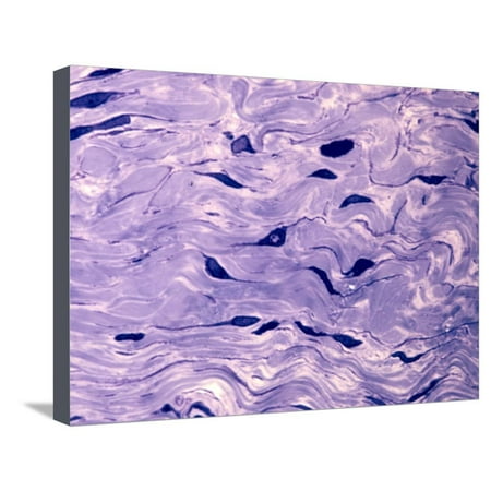 - Collagen in Dense Connective Tissue Stretched Canvas Print Wall Art By David Phillips
