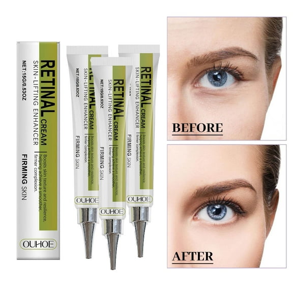 ONLYEOR Wrinkle Firming Face Cream, Retinol & Hyaluronic Acid Cream, Anti-Aging Face Moisturizer for Face, Instant Face Lift & Skin Tightening Cream, Rapid Wrinkle Remover for Cheek and Neck 15g