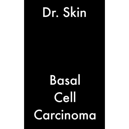 Basal Cell Carcinoma - eBook (Best Natural Treatment For Basal Cell Carcinoma)