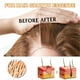 thumbnail image 5 of Esencial Para El Crecimiento Del Cabello Tmvgtek Cuidado Belleza, 5 of 9