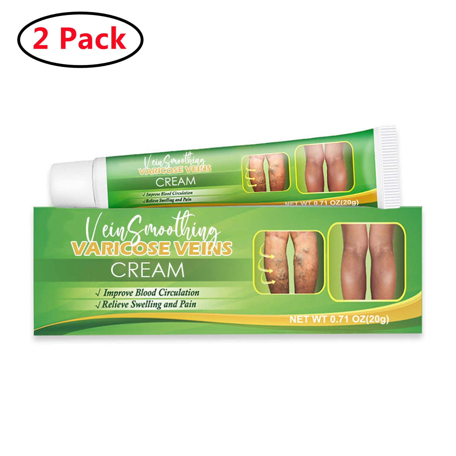 2 Pack Vein Care Fading Cream,Anti Varicose Vein Soothing Leg, Improve