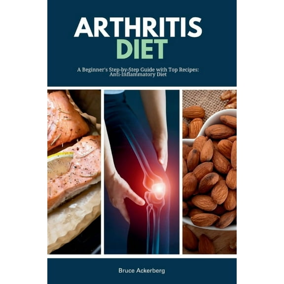 Arthritis Diet: A Beginner's Step-by-Step Guide with Top Recipes: Anti-Inflammatory Diet, (Paperback)