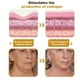 thumbnail image 5 of Bee Venom Wrinkle Removal Cream,Bee Venom Anti-Wrinkle Firming Moisturizing,Lifting & Recovery for All Skin Types 2025, 5 of 5