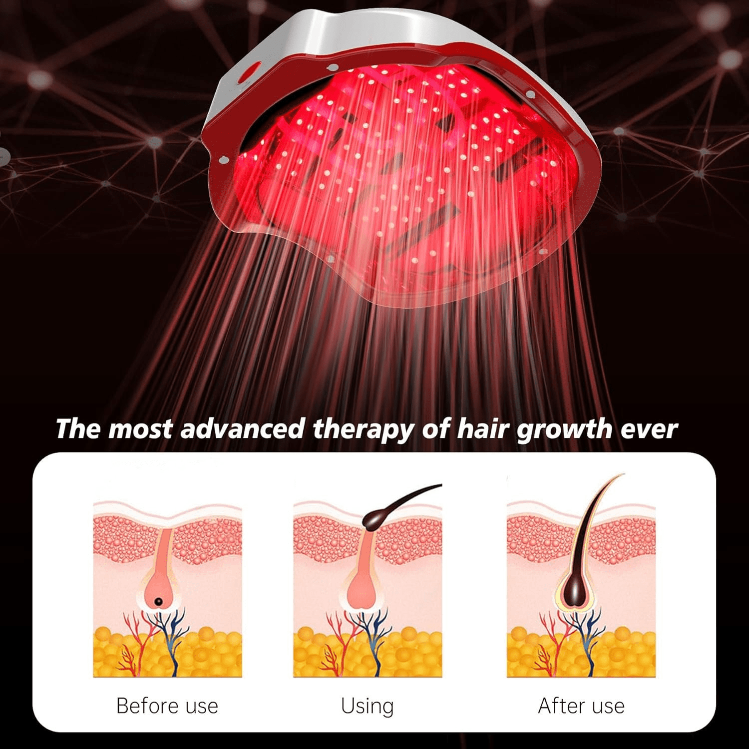 Red Light Wellness Helmet for Scalp Care Support, Portable Hands-Free Device with Dual-Light LEDs and Timed Sessions for Men and Women, Personal Care Accessory