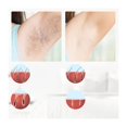 thumbnail image 2 of Epilator IPL hair removal device, laser hair removal for permanent hair removal Smooth skin with, IPL devices hair remover, 2 of 5