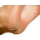 thumbnail image 3 of Solución Removedora de Callos Certus Pharma Cuidado de la Salud Esencial, 3 of 3