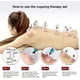 thumbnail image 2 of Juego de terapia de ventosas YONGSHENG 24 tazas con bomba para masaje y celulitis, 2 of 4