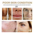 thumbnail image 5 of Turmeric Essence Remove Dark Spots Repair Anti-aging Fade Fine Lines And Wrinkles Skin Moisturizing Moisturizing Essence, 5 of 5