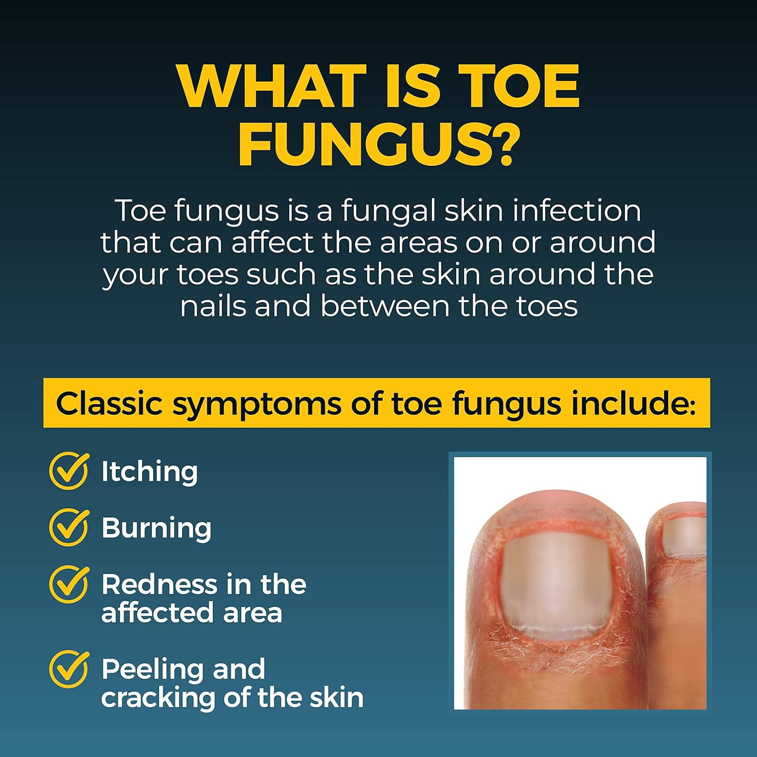 Fungi-Nail Solution, Anti-Fungal Liquid with 1% Tolnaftate, 1 Fl oz