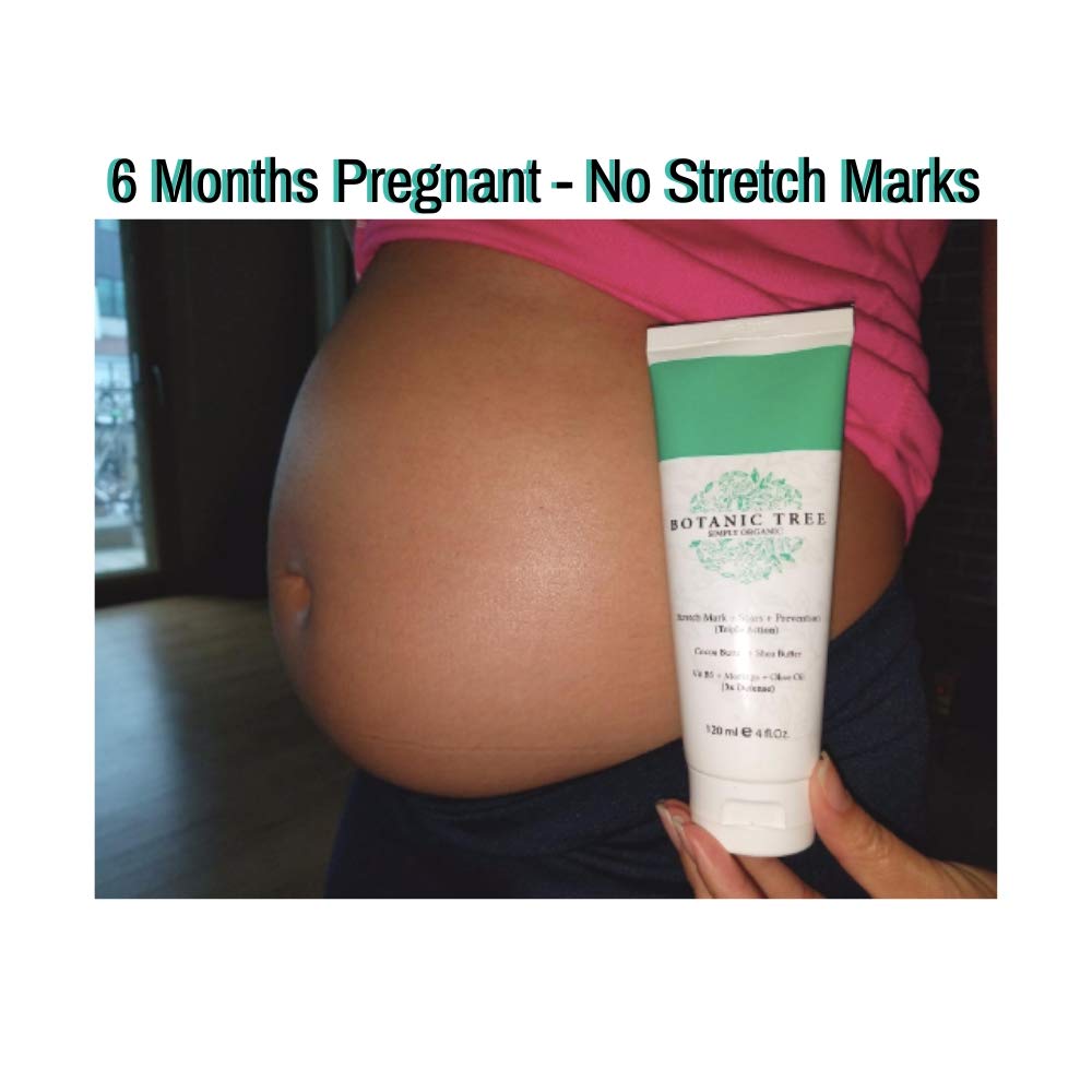 botanic tree stretch marks cream