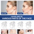 thumbnail image 2 of Cinta de estiramiento facial AndoBubblu invisible para levantar la piel flácida, 2 of 9