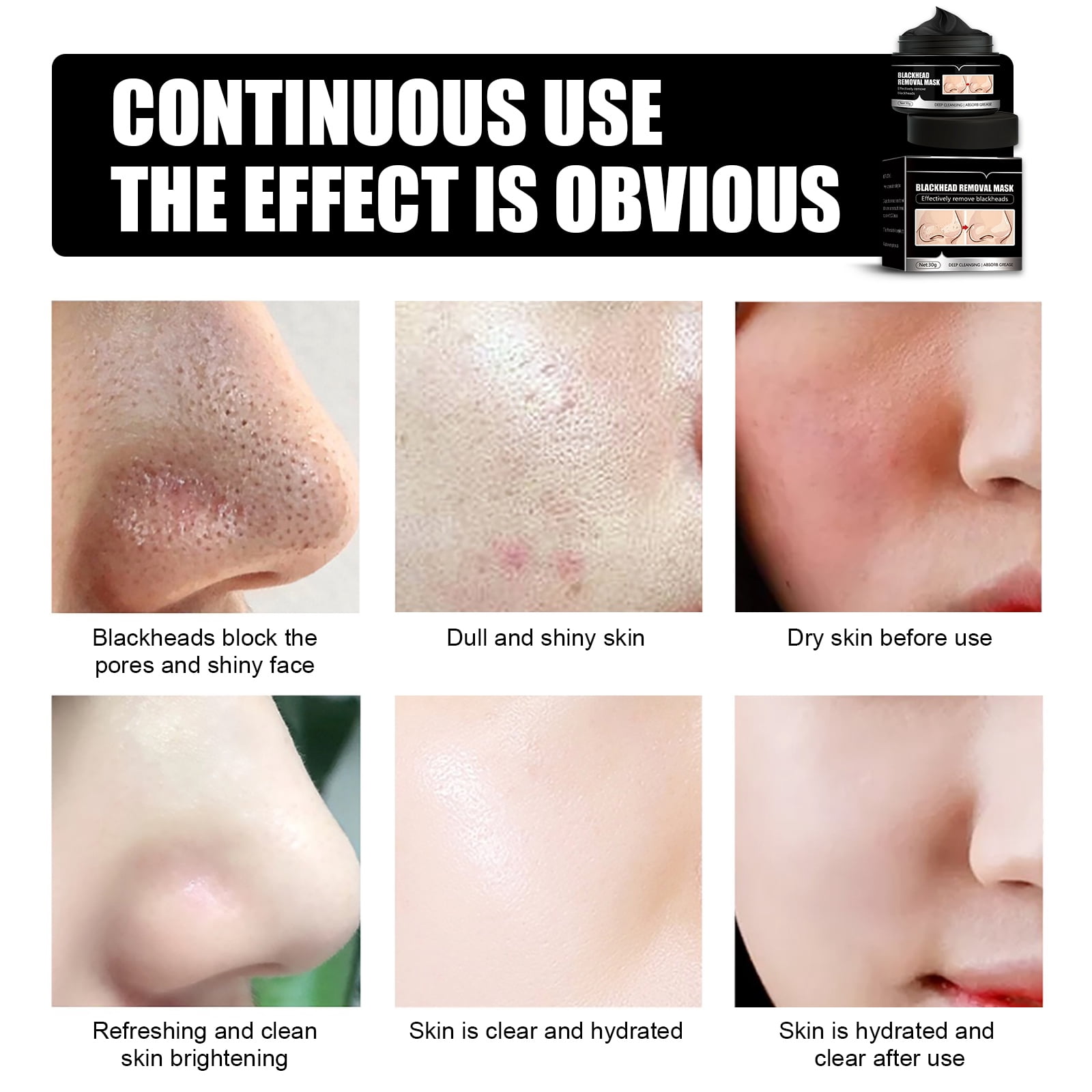 Alvantor Blackhead Remover Mask, Charcoal Peel off, Pore Minimizer, 1.05oz