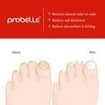 thumbnail image 4 of Probelle Tratamiento Natural Liquido Antihongos para Uñas. Restaura el Color y Belleza a Uñas Dañadas por Hongos, Formula Patentada. 0.5 FL OZ | 15 ML Probelle Natural Fungal Nail Liquid Treatment, 4 of 4