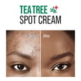 thumbnail image 6 of KISS NEW YORK Tea Tree Spot Cream Korean Skincare Lightweight Face Spot Cream for Blemishes, 6 of 8