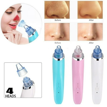 Electric Blackhead Remover Pore Vacuum Suction Diamond Dermabrasion Face Cleaner Black Head Vacuum (Best Face Wash For Blackheads And Whiteheads)