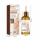 thumbnail image 3 of Fiudx Liquidación De Ahorros De Verano Abrillantador De Articulaciones, Blanqueamiento De Axilas, Codo, Blanqueamiento De La Piel, Suero De Eliminación De Melanina De Rodilla, 50Ml, 3 of 6